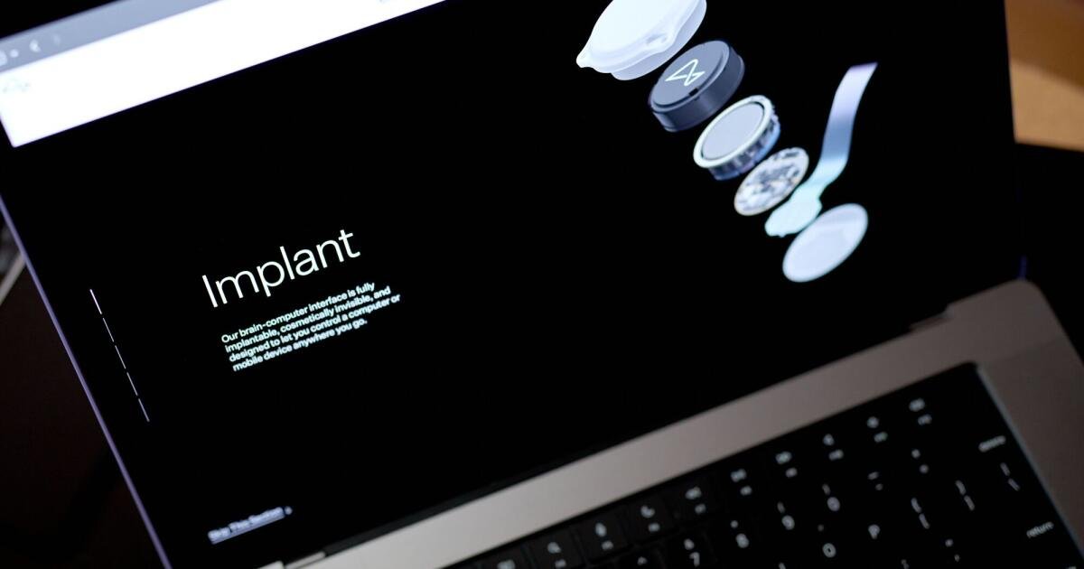 El dispositivo Neuralink ayuda a Monkey a ver algo que no está allí