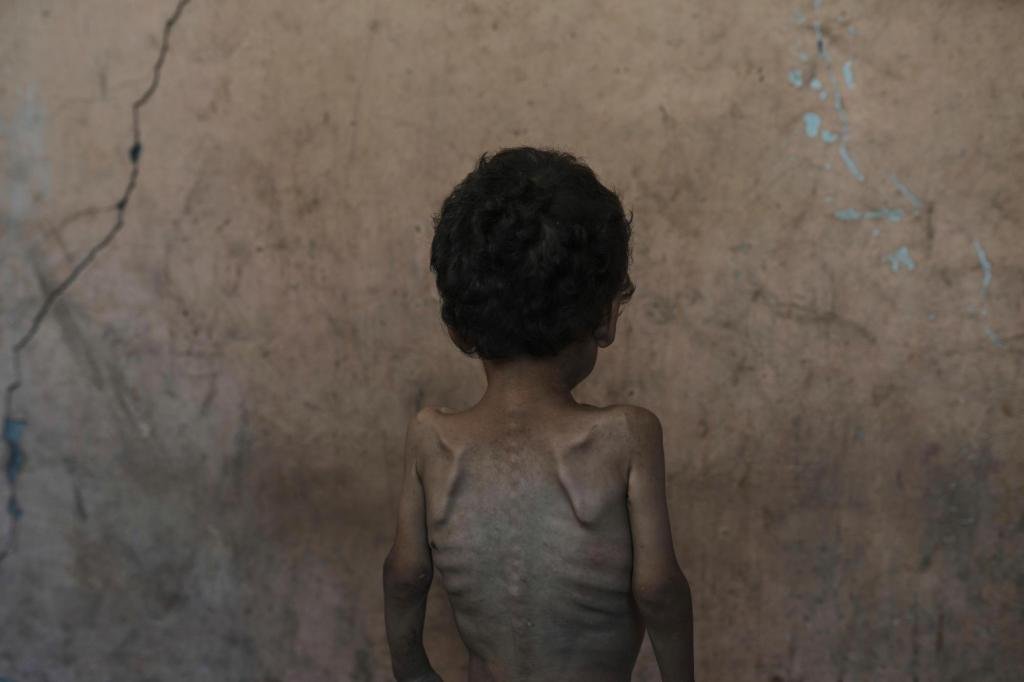 ‘El peor de los casos de la hambruna’ está sucediendo en Gaza, advierten los expertos en crisis alimentaria