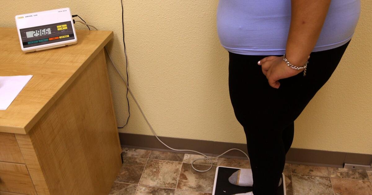 La obesidad severa en los niños de EE. UU. Se ha más que triplicado desde 2008